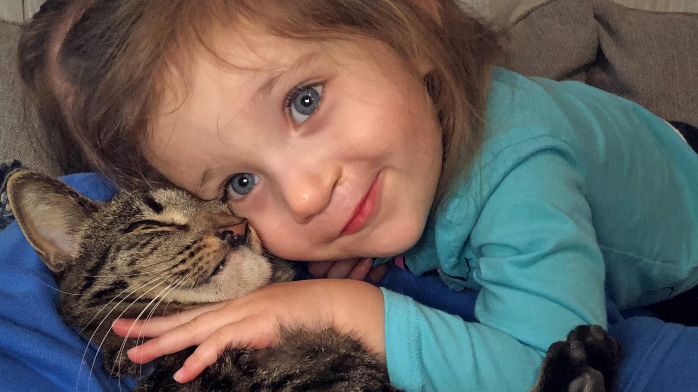 Девочка подружилась с котом, который имеет схожую с ней особенность: что их объединило - Pets Девочка подружилась с котом, который имеет схожую с ней особенность: что их объединило - Pets