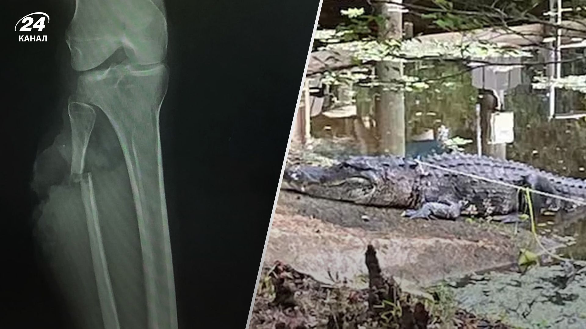 В США женщина вырвалась из пасти аллигатора В США женщина вырвалась из пасти аллигатора